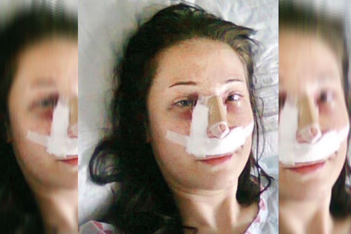 Sevinc Ceklik se sometió a una operación de nariz y poco más de un mes después le debieron amputar las piernas