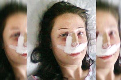 Sevinc Ceklik se sometió a una operación de nariz y poco más de un mes después le debieron amputar las piernas