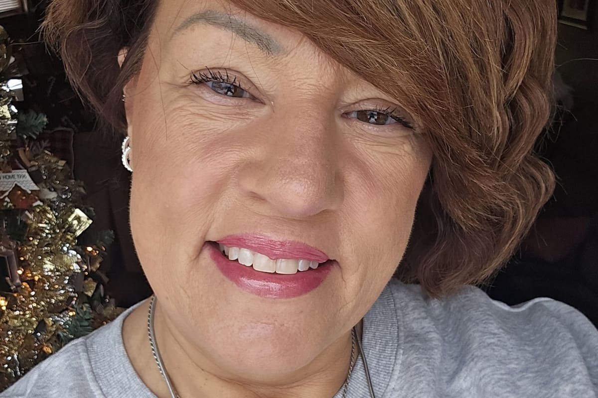 Sharon Lupo detectó una señal de cáncer en el cuero cabelludo de una clienta