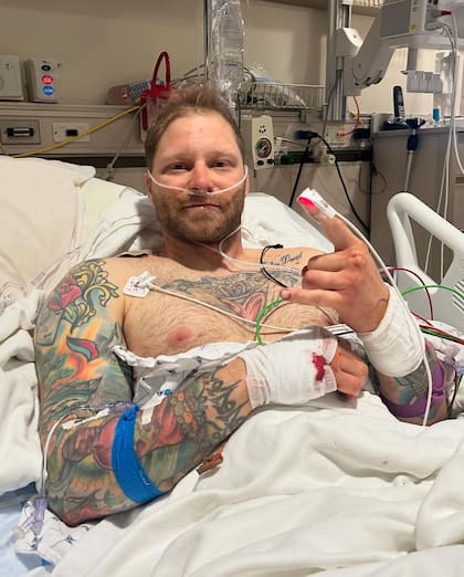 Shayne Patrick fue internado luego del brutal ataque de un oso