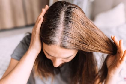 Si las canas no están desde hace mucho tiempo, es más probable que si están causadas por estrés, puedan desaparecer
