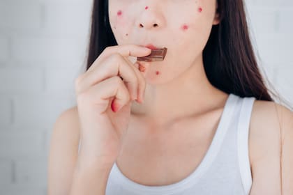 Si padeces acné severo o algún problema cutáneo grave, la experta recomienda que consultes con tu médico de cabecera o un dermatólogo en lugar de buscar consejos en las redes sociales sobre cómo controlarlo