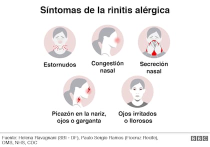 Síntomas de la rinitis alérgica