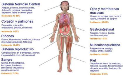 Síntomas del Lupus