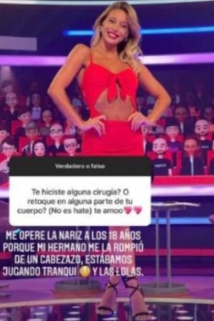 Sol Pérez develó la cantidad de cirugías a las que se sometió