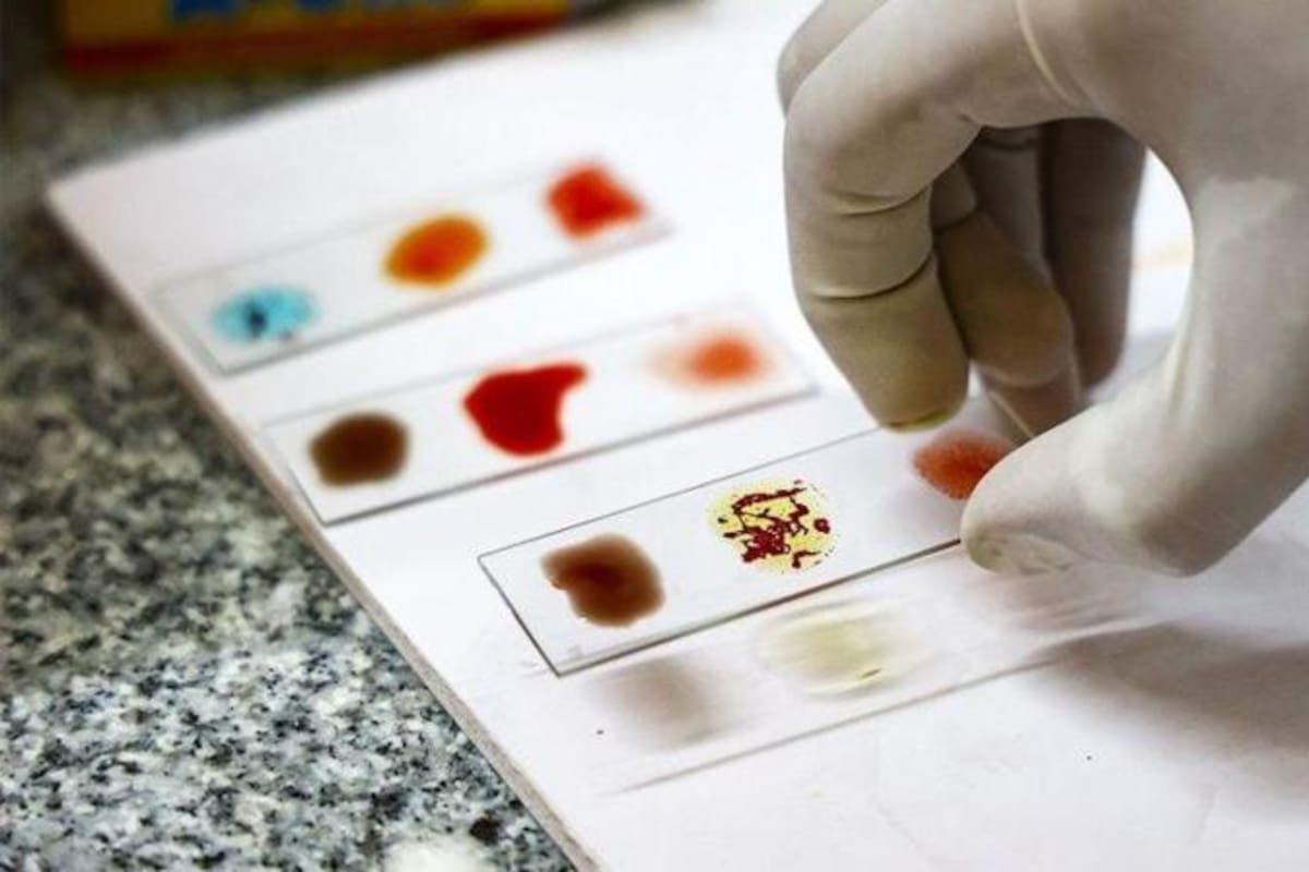 Solo se conocen 50 personas en el mundo con el tipo de sangre Rh nulo