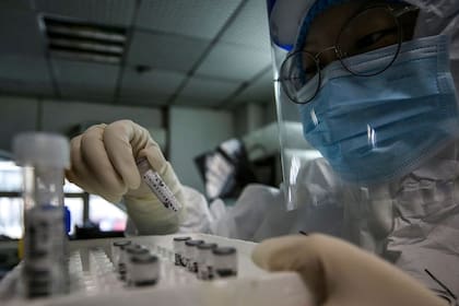 Son defectuosos los test que el Gobierno hizo traer de China