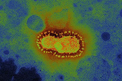 COVID-19 es el nuevo nombre oficial de la infección respiratoria causada por la cepa 2019-nCoV de la familia de los coronavirus