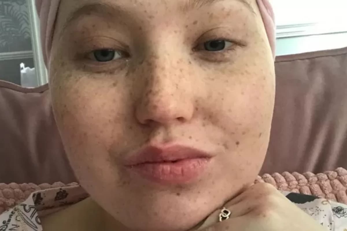 Sophie Wheldon recibió su diagnóstico cuando era estudiante