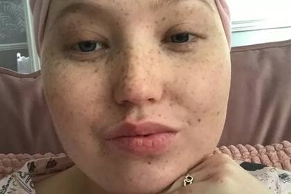 Sophie Wheldon recibió su diagnóstico cuando era estudiante