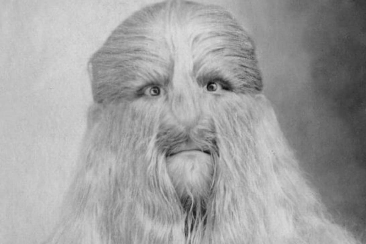 Stephan Bibrowski ganó fama mundial por su enfermedad (Foto Instagram @Curiotweet1)