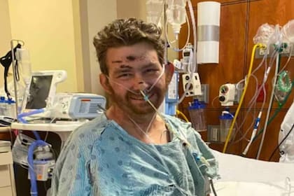 Steven se recuperó tras estar en coma
