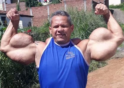 Su caso generó debate sobre el uso de sustancias prohibidas en el cuerpo (Foto: X)