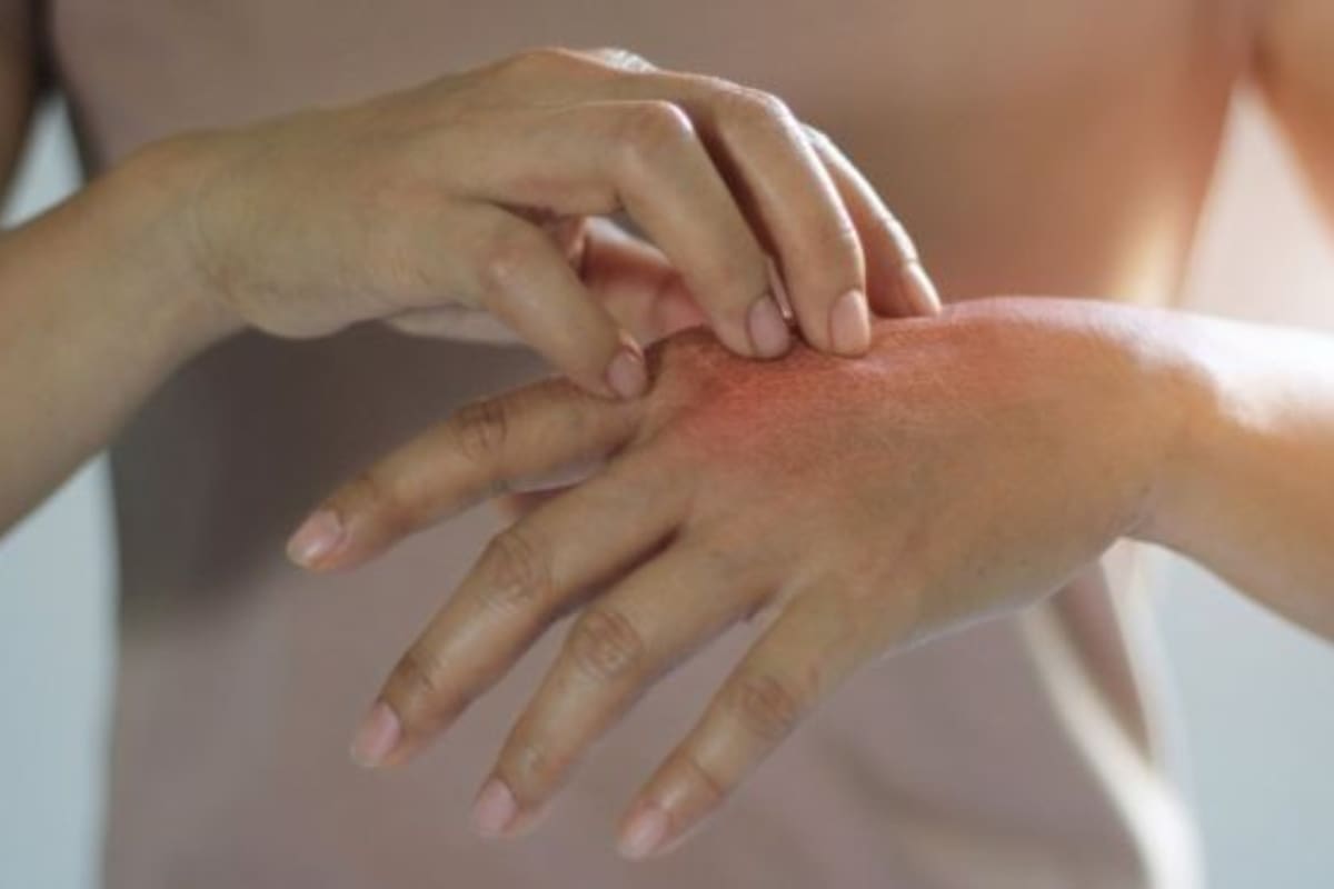 Su causa es multifactorial, y tiene que ver con la predisposición genética