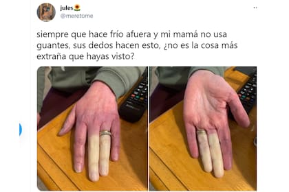 Su hija Julie relató cómo sobrelleva la enfermedad que padece desde hace 20 años