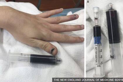 Sucedió en Estados Unidos; tiene 25 años