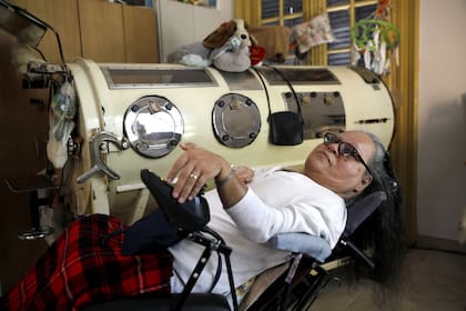 Susana Gómez debe dormir en un pulmotor por las secuelas de la polio