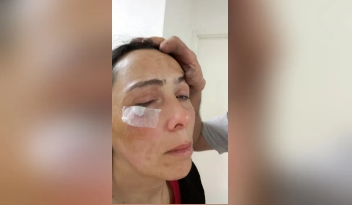 Susana sufría maltrato hasta que decidió irse de la casa y denunciar a su pareja