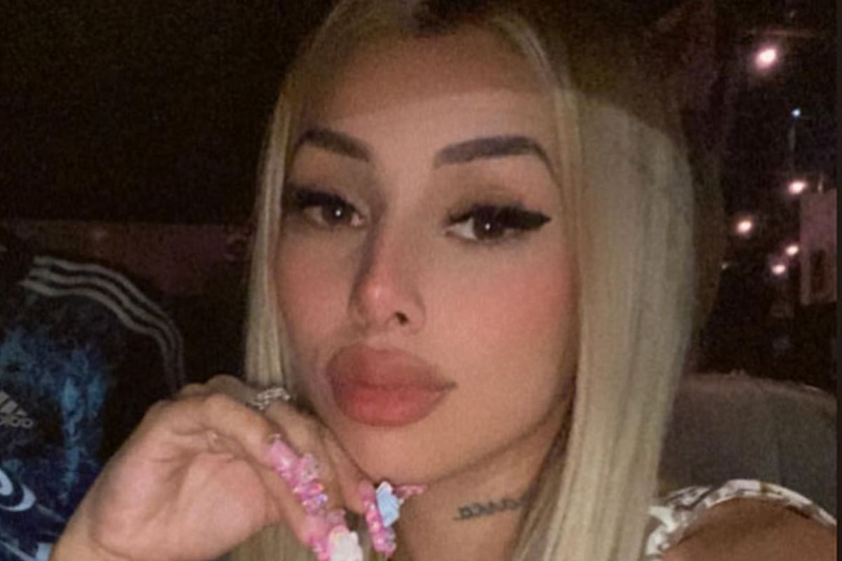 Tamara Báez mostró su nuevo retoque estético (Foto: Instagram @tamibaez429)