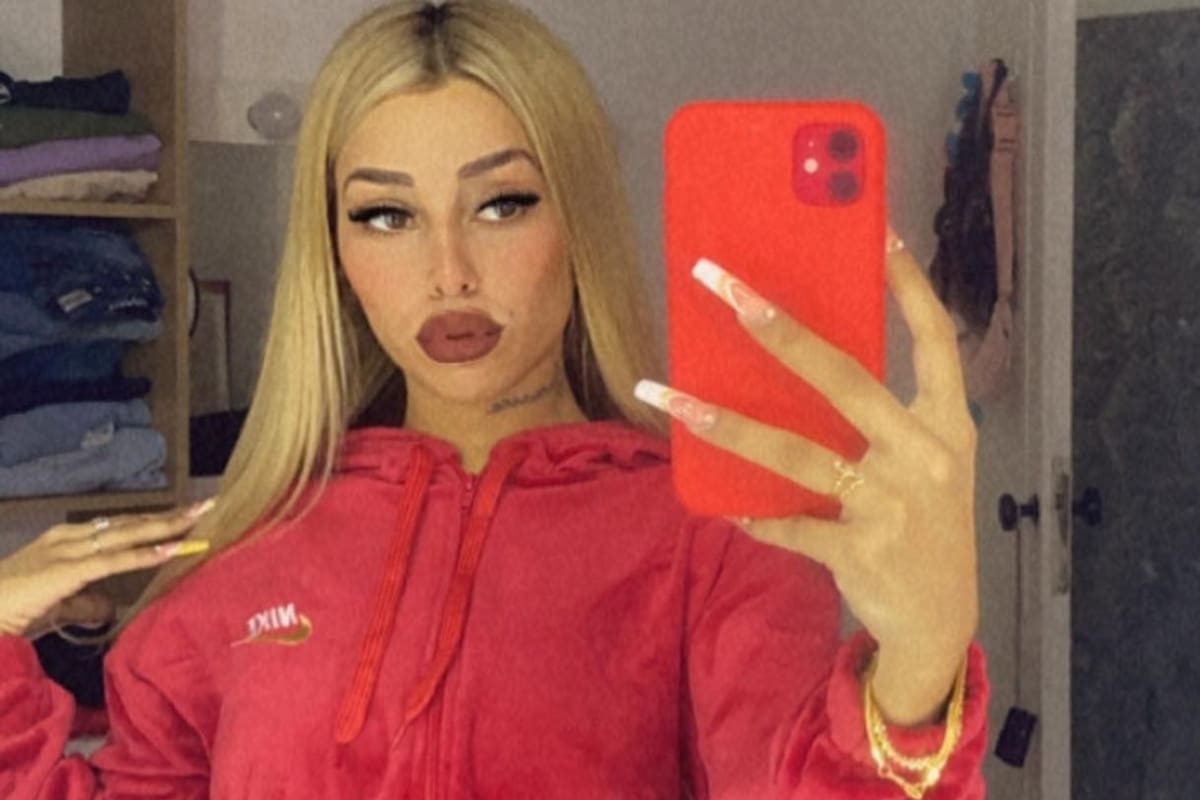 Tamara Báez mostró su último retoque estético en redes