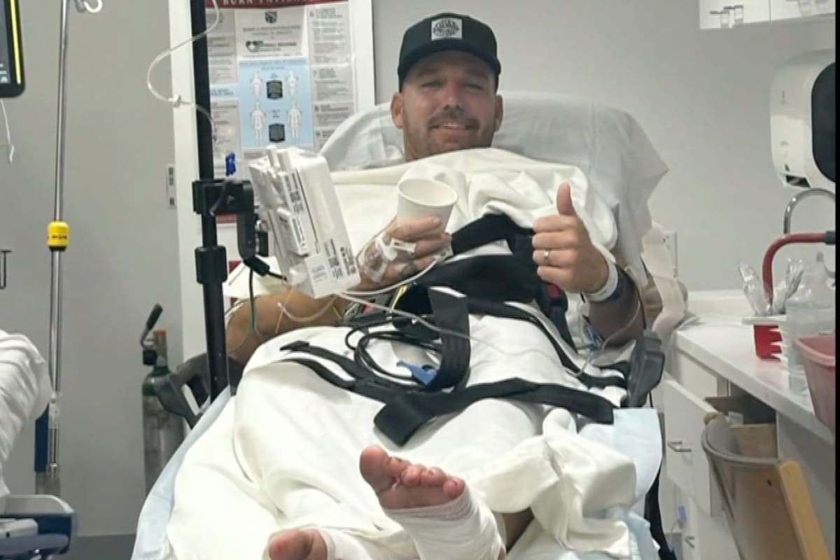 Taschman ya había sido mordido por otro tiburón en el año 2013 (Instagram)