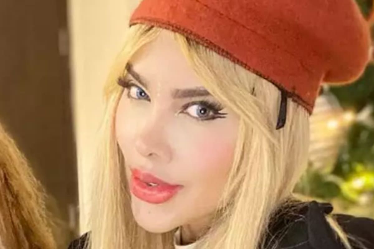 Tatiana Murillo sostuvo que su hija "ya cumplió uno de sus sueños, que era una rinoplastia"