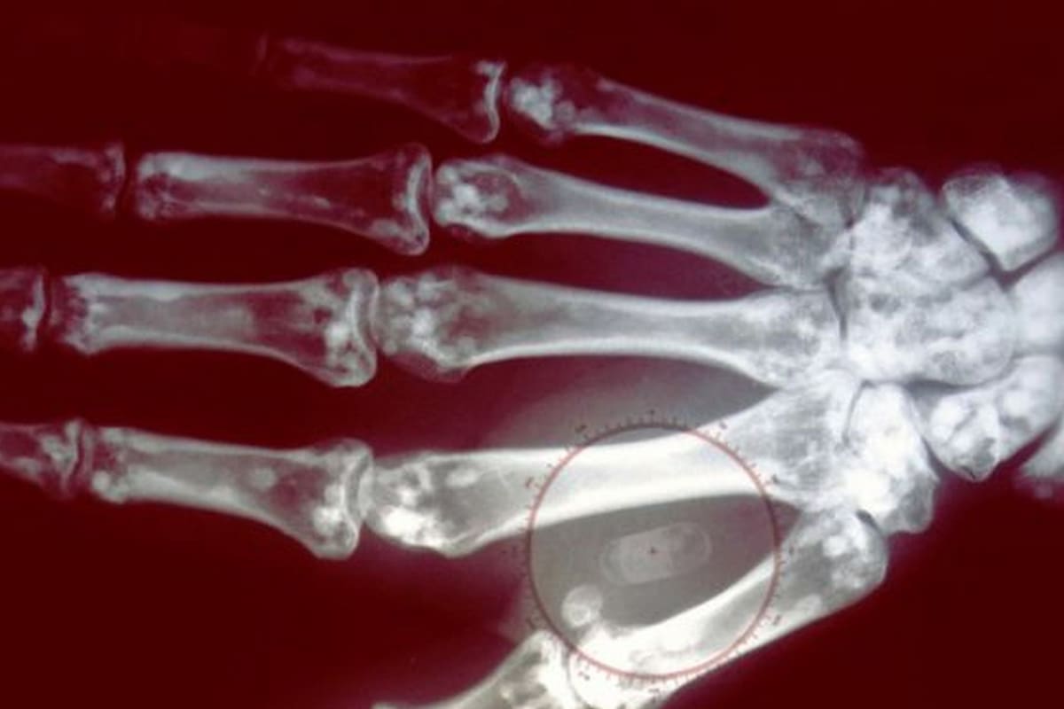 ¿Te implantarías el microchip para pagar sin tarjeta?