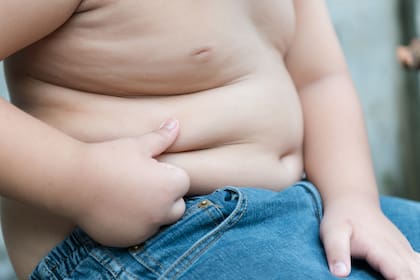 Si bien la obesidad tiene un gran componente genético, los malos hábitos forman una parte importante del problema