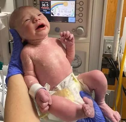 Theo se convirtió en el primer bebé británico en ser operado en el útero para corregir una gastrosquisis compleja