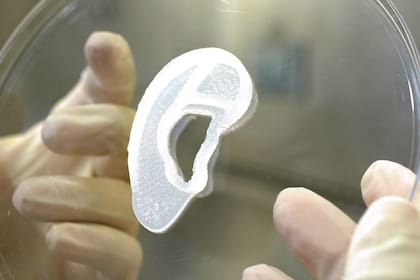 Un bioimplante 3D de un lóbulo de la oreja