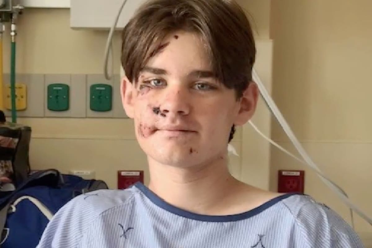 Tiene 13 años, se resbaló en el Gran Cañón y cayó de 30 metros de altura