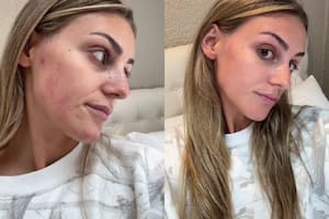 Tiffany Henriques muestra los beneficios de dejar de consumir azúcar