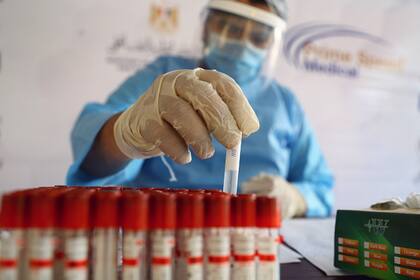 “Todavía estamos aprendiendo sobre la naturaleza de la respuesta inmune relacionada con manifestaciones graves, leves y asintomáticas de COVID-19” afirma Andrea Gamarnik