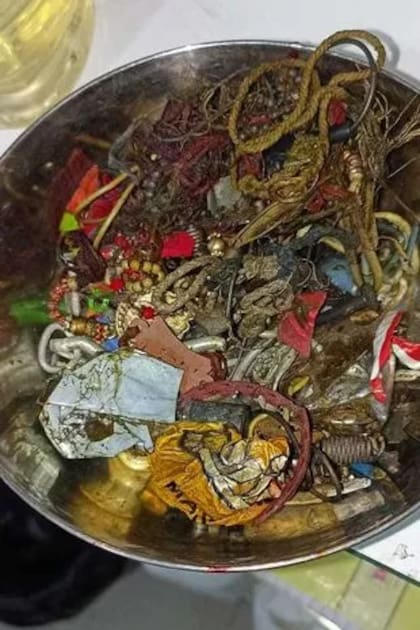 Todos estos objetos encontraron cuando operaron al hombre (Foto: X/@scarcestories)
