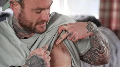 Tom Powell asegura que no solo sufrió efectos secundarios psicológicos, sino que los esteroides le provocaron un exceso de tejido mamario que tuvo que ser extirpado