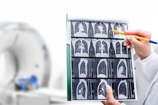 Un fármaco experimental combate un cáncer que va en aumento y ya es el quinto más mortal