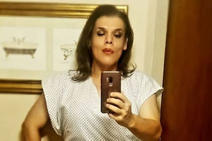 Tras adelgazar más de 100 kilos, Costa se sometió a un procedimiento estético en el que le quitaron más de 36 centímetros de piel