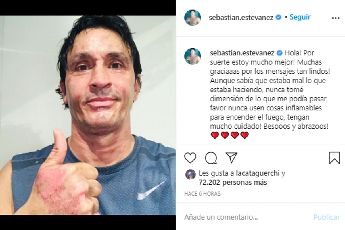 Tras el accidente, Sebastián Estevanez compartió una foto en redes sociales