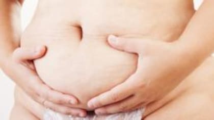 Tras las gestación y el parto los músculos abdominales se pueden quedar estirados, debilitados y separados