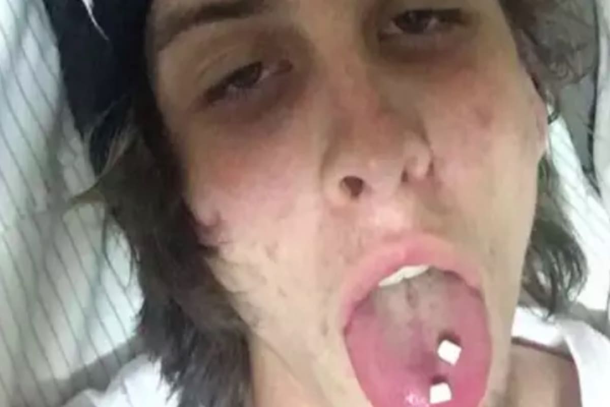 Travis Robinson compartió imágenes del antes y después de su tratamiento para combatir la adicción a las drogas y los cambios resultan impactantes