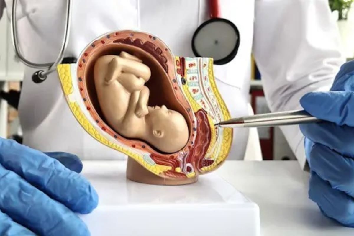 Tres equipos médicos trabajan en alternativas para el desarrollo de bebés prematuros en úteros artificiales