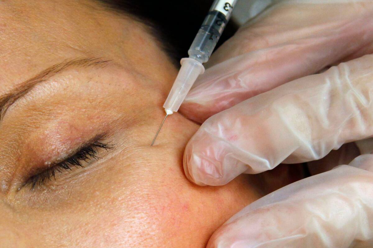 Tres mujeres fueron diagnosticadas con VIH después de recibir procedimientos “faciales vampiro” en un spa médico no autorizado de Nuevo México. Foto ilustrativa (AP Foto/Jacquelyn Martin, Archivo)