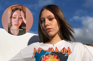 Le diagnosticaron un tumor en la cabeza y gracias a un video viral consiguió la prótesis que necesita para operarse