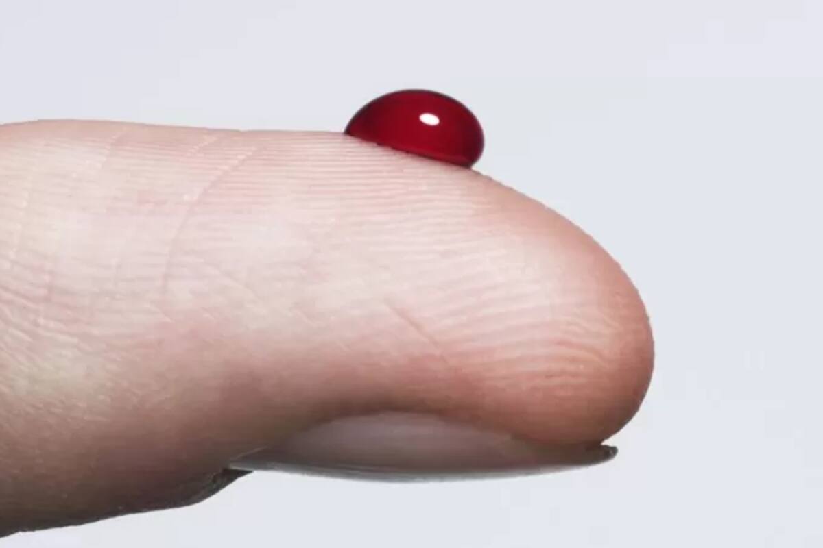 Un análisis de sangre de rutina sirve para alertar a tiempo sobre un desorden que se hereda en las familias