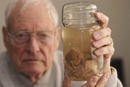Un anciano Thomas Harvey con un trozo del famoso cerebro