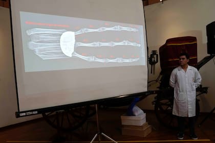 Un arqueólogo forense presenta una proyección de una presunta mano de tres dedos, que fue interceptada por las autoridades en la aduana, en el Museo de Arqueología en Lima, Perú, el viernes 12 de enero de 2024. De acuerdo con el arqueólogo forense de la fiscalía peruana Flavio Estrada, dos supuestos muñecos y la mano de tres dedos, que tenían como destino México, fueron en realidad construidos con papel, pegamento, metal y huesos de humanos y animales. (AP Foto/Martín Mejía)