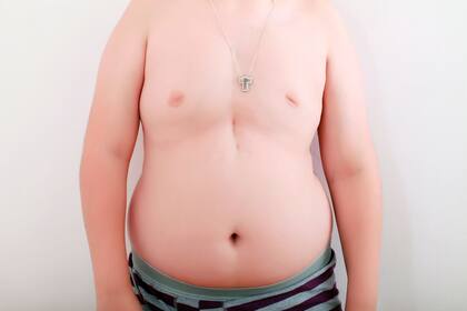 Un caso polémico en Inglaterra