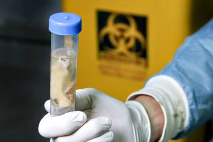 Un científico sostiene una muestra de cerebro de una vaca con la enfermedad