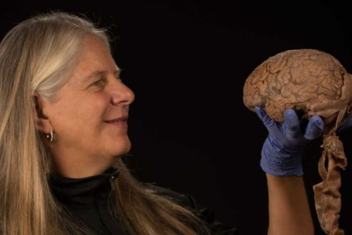 Un derrame cerebral cambió para siempre la vida de la neurocientífica estadounidense Jill Bolte Taylor