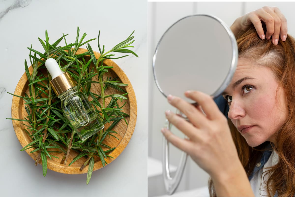 Un ensayo clínico comparó el romero con un tratamiento aprobado para la alopecia y registró mejoras recién a los seis meses